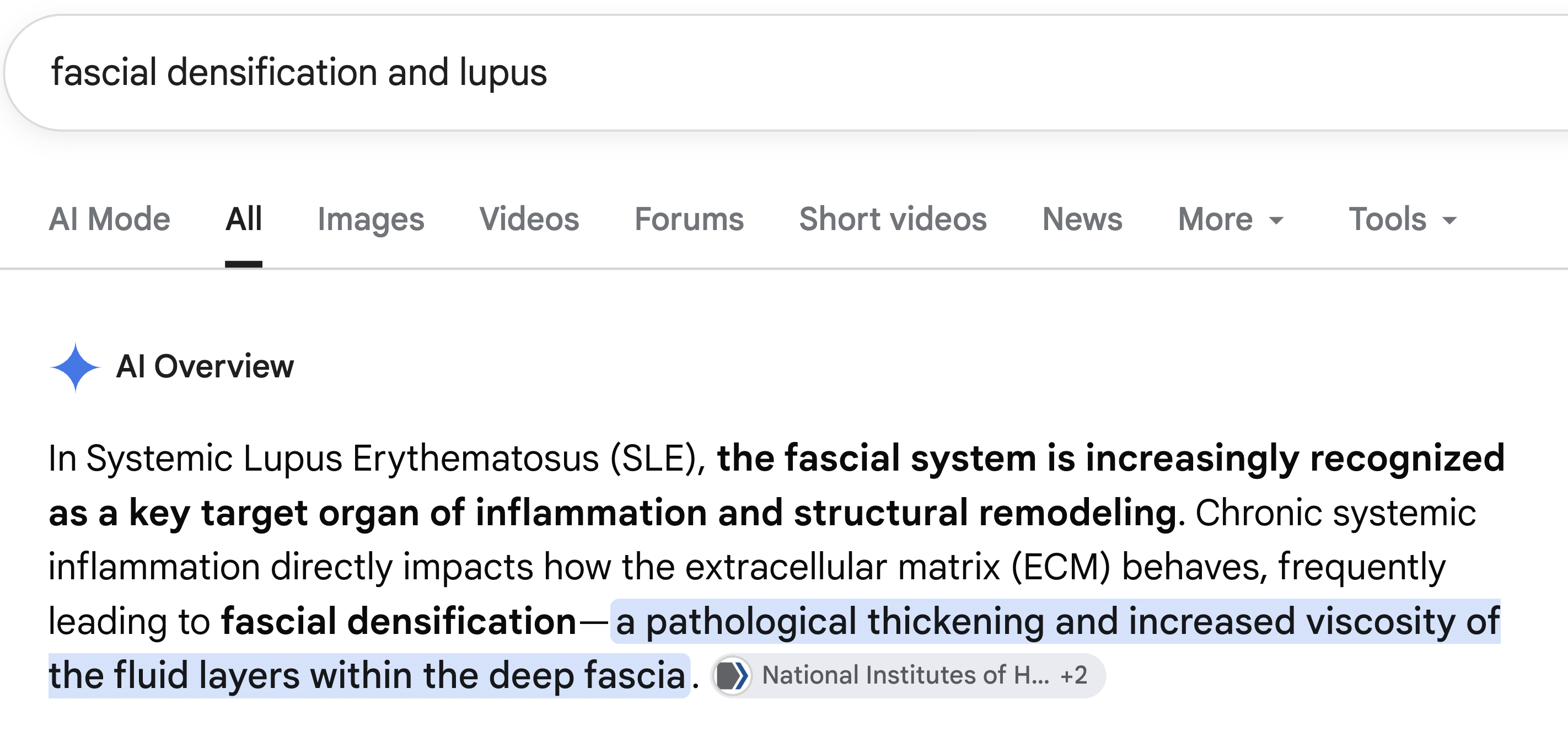 Search result: fascial densification and lupus